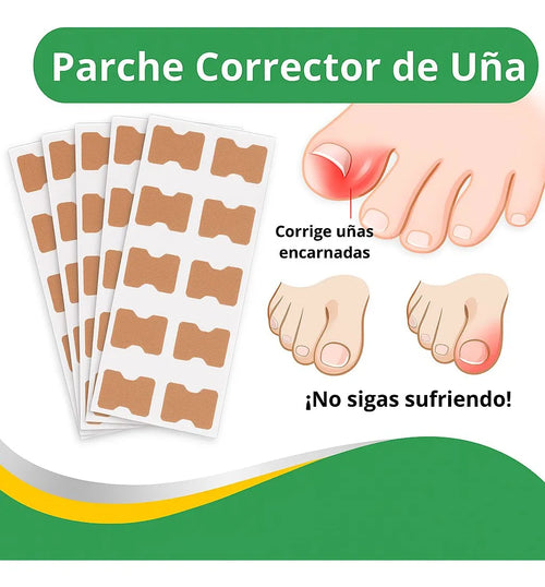 PediFlex™ - Solución Definitiva para Uñas Encarnadas