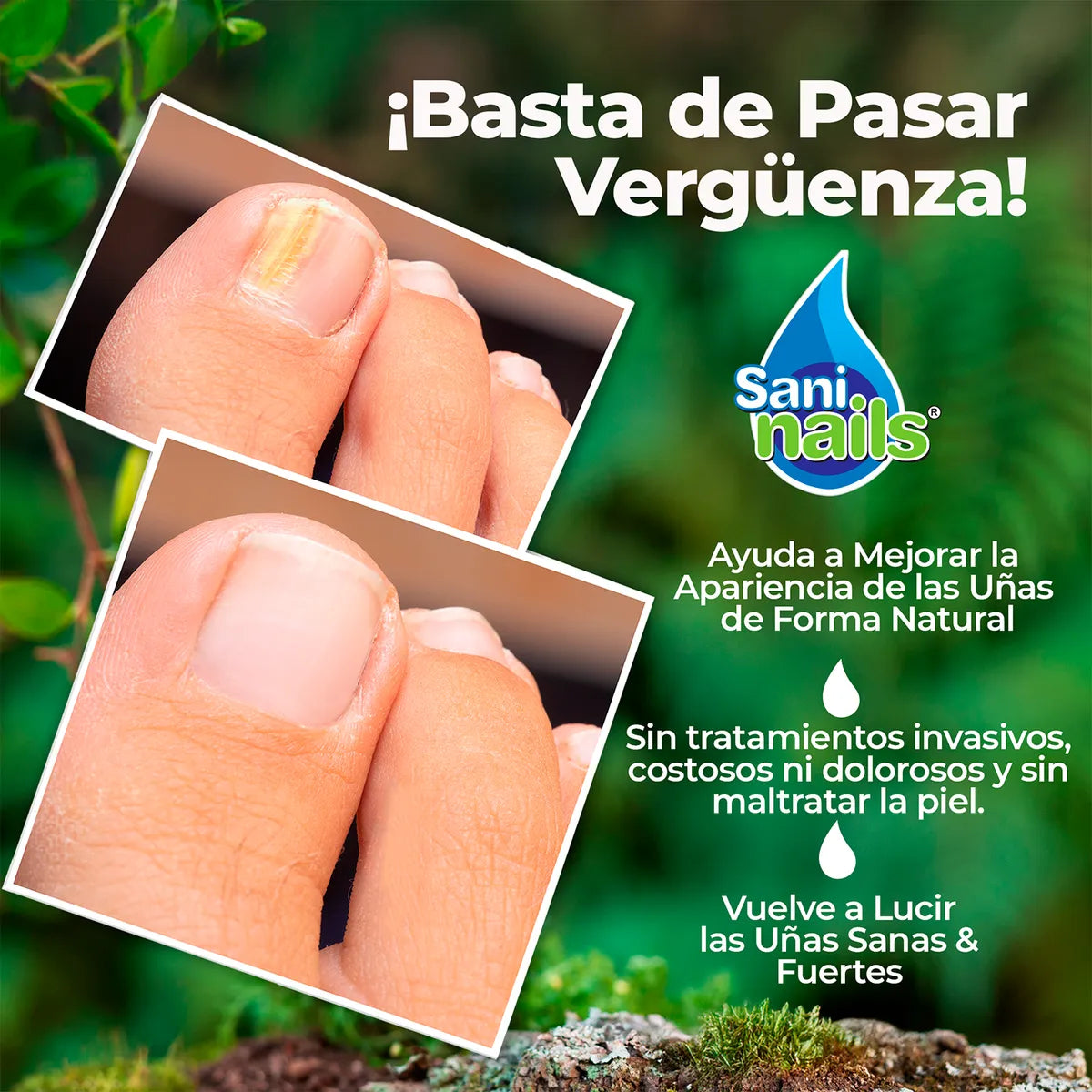 Sani Nails™ – Elimina el Hongo de las Uñas