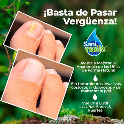 Sani Nails™ – Elimina el Hongo de las Uñas